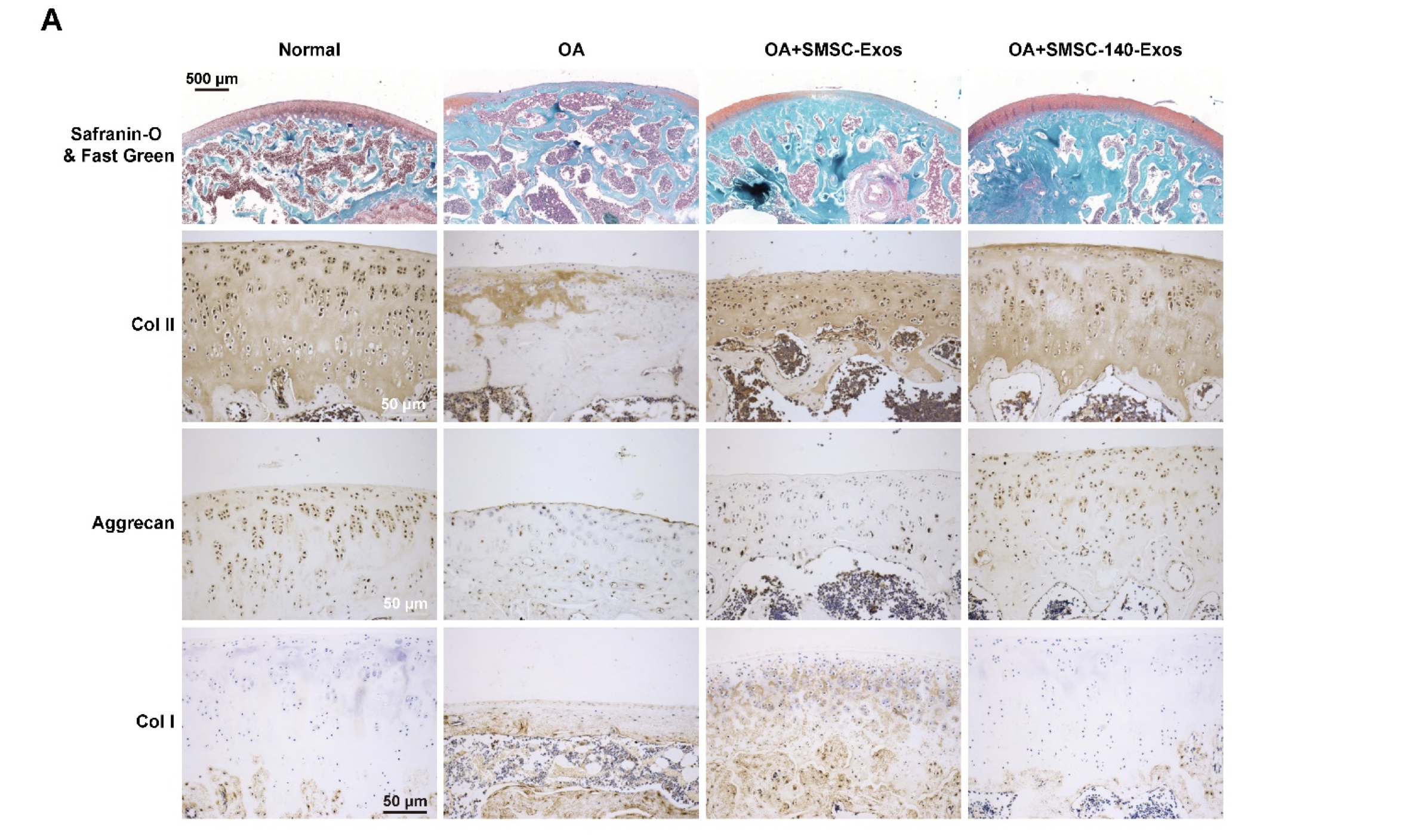 Mesenchymal Stem Cells in Osteoarthritis